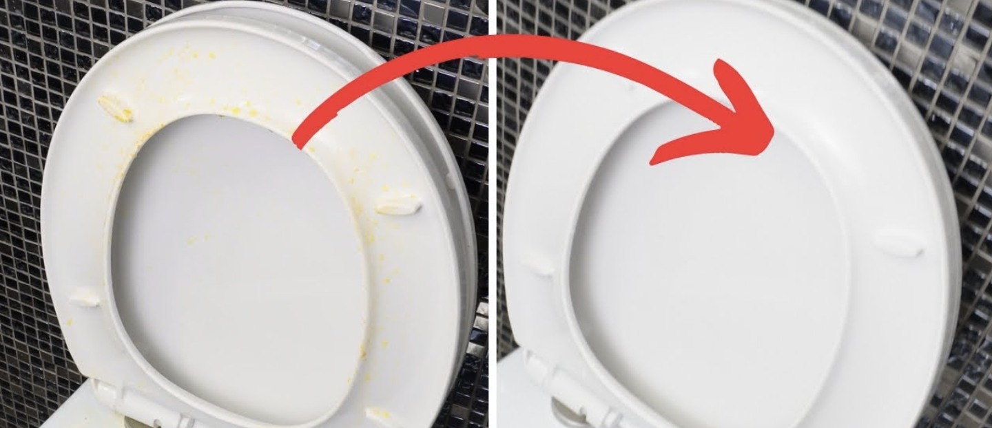 Hoe Krijg Je Gele Aanslag Uit De Wc